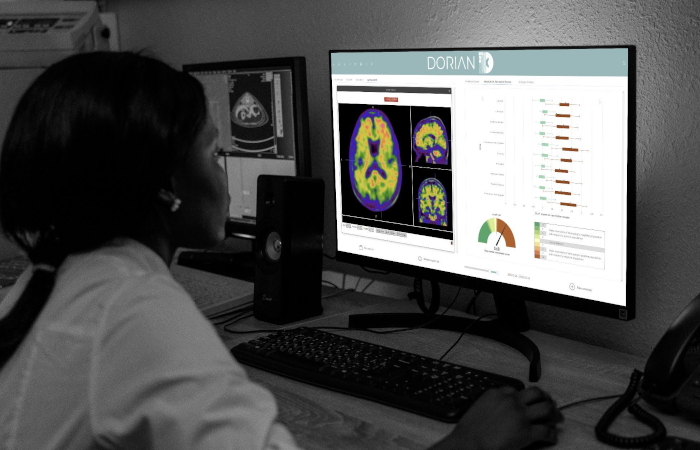 persona in ombra vista di tre quarti alle spalle che guarda lo schermo di un PC dove ci sono immagini di diagnostica medica e il logo Dorian Technologies